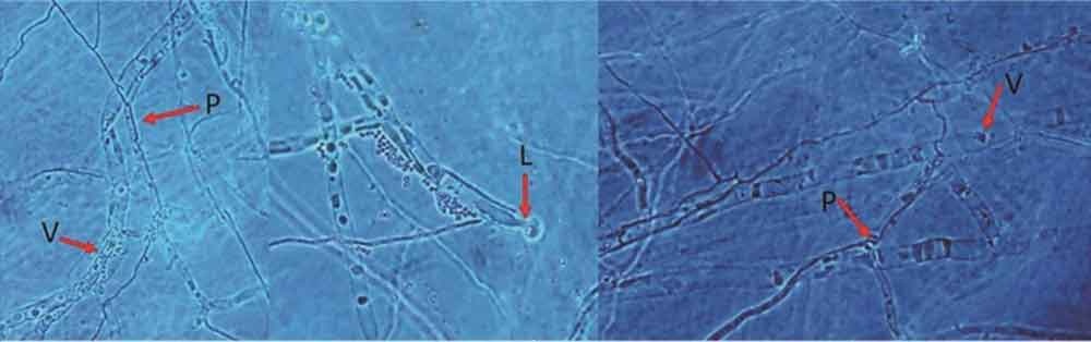 Interacciones hifales entre el aislado T.949 de Trichoderma sp.y C. cassiicola (400x)